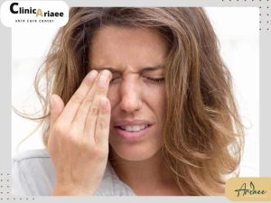 خارش بعد از کاشت ابرو