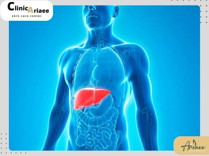  آیا کبد چرب باعث ریزش مو می‌شود؟