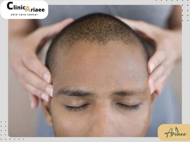 ماساژ سر پس از کاشت مو