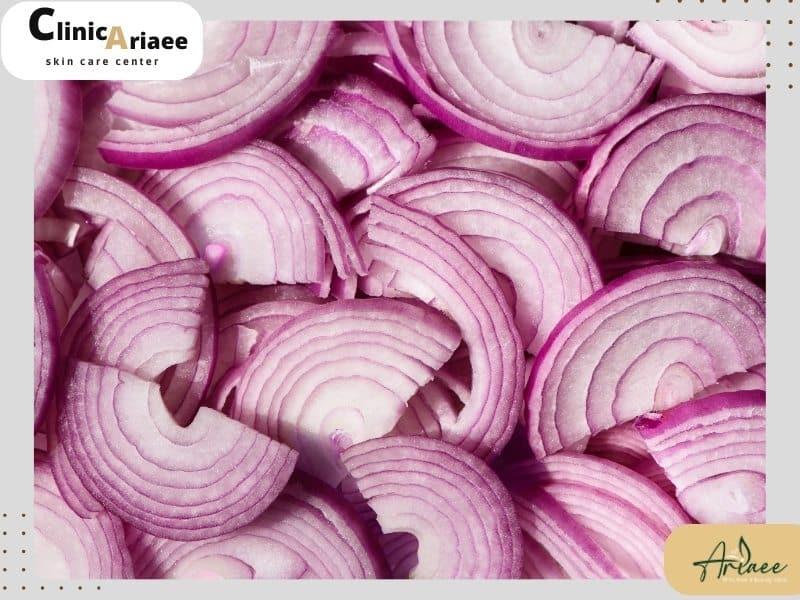 خواص پیاز در بهبود پس از کاشت مو