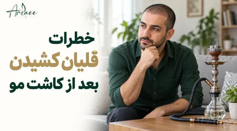 خطرات قلیان کشیدن بعد از کاشت مو