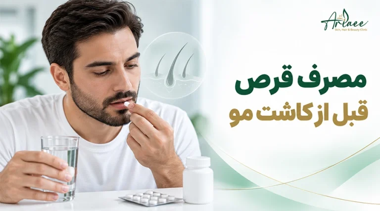 مصرف قرص قبل از کاشت مو