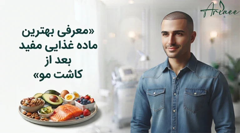 معرفی بهترین ماده غذایی مفید بعد از کاشت مو