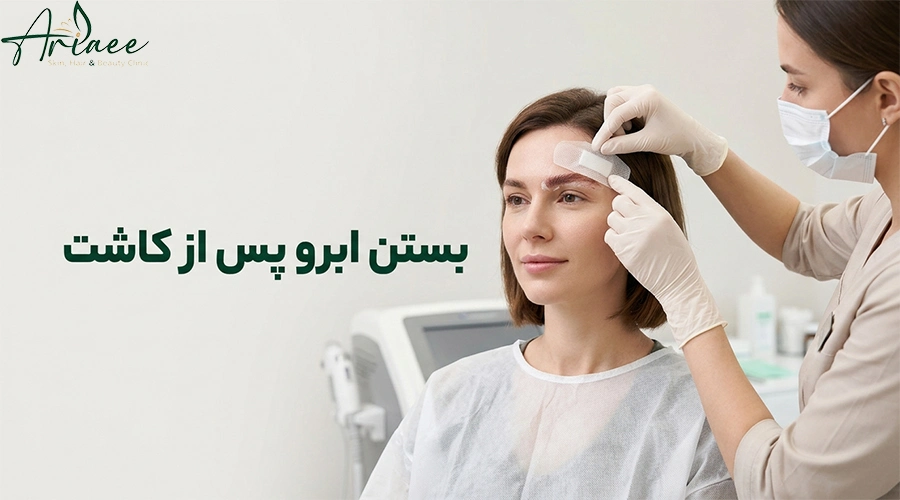 بستن ابرو پس از کاشت