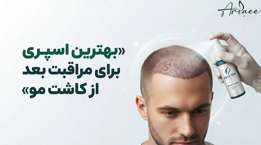 بهترین اسپری برای مراقبت بعد از کاشت مو