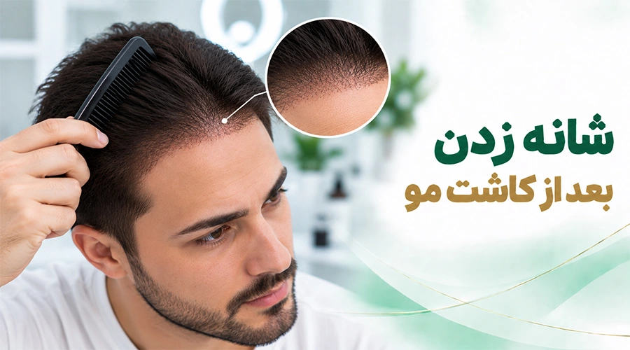 شانه زدن بعد از کاشت مو