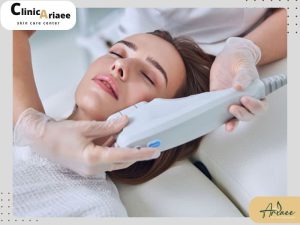 ویژگی‌های بهترین مرکز هایفوتراپی در تهران