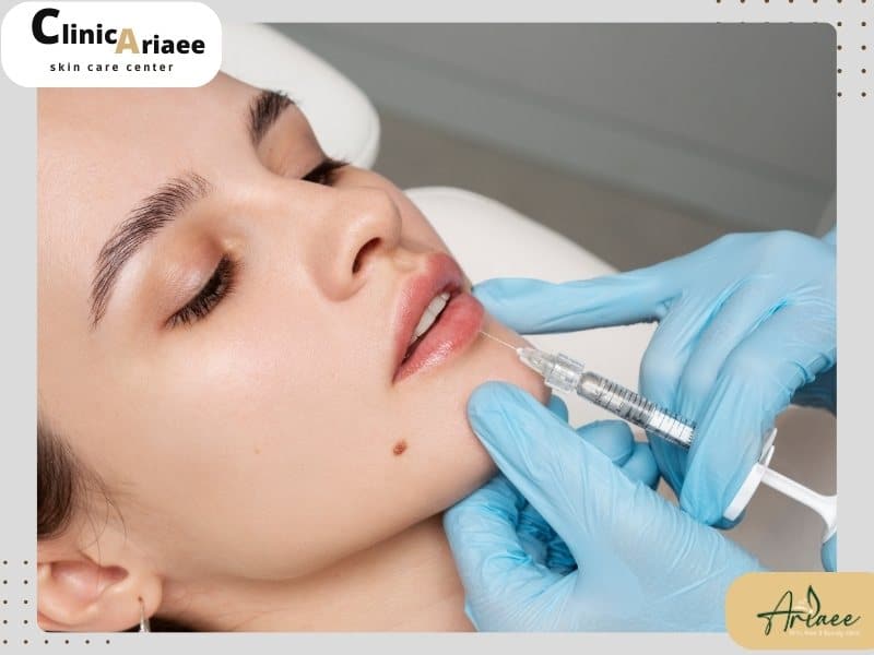 ویژگیهای بهترین برند ژل لب