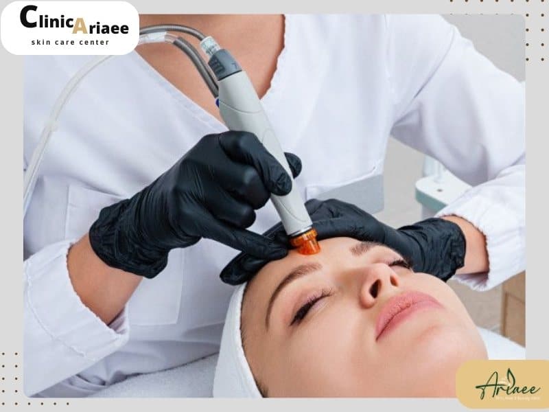 مراقبتهای بعد از لیزر فوتونا