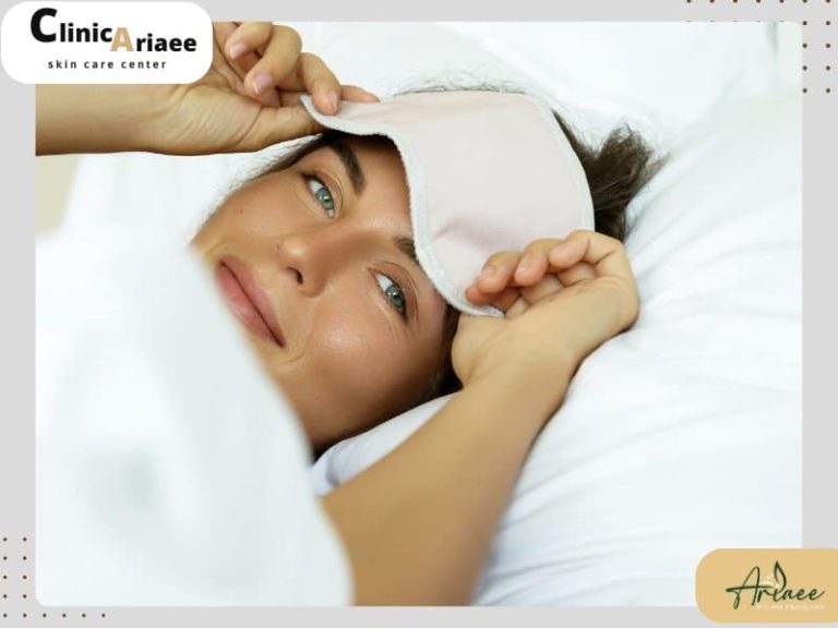 نحوه خوابیدن بعد از لیفت با نخ