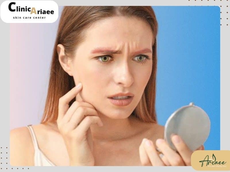 زخم و قرمزی بعد از ریموو ابرو