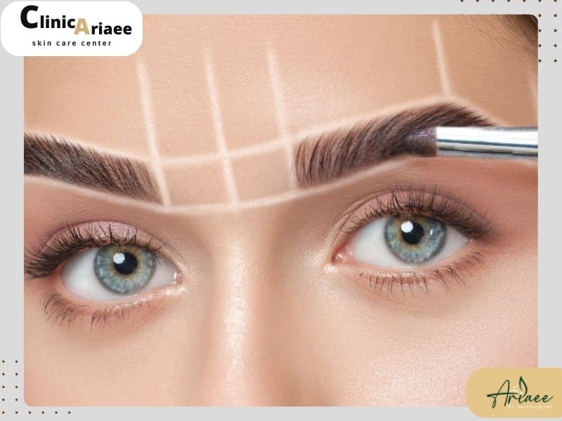 محدودیتها و شرایط ویژه برای استفاده از روش بیوفایبر