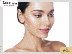 مراقبت های بعد از هایفوتراپی