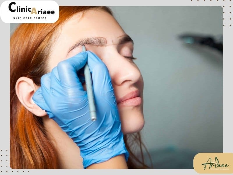  مشکلات و عوارض احتمالی پس از کاشت ابرو