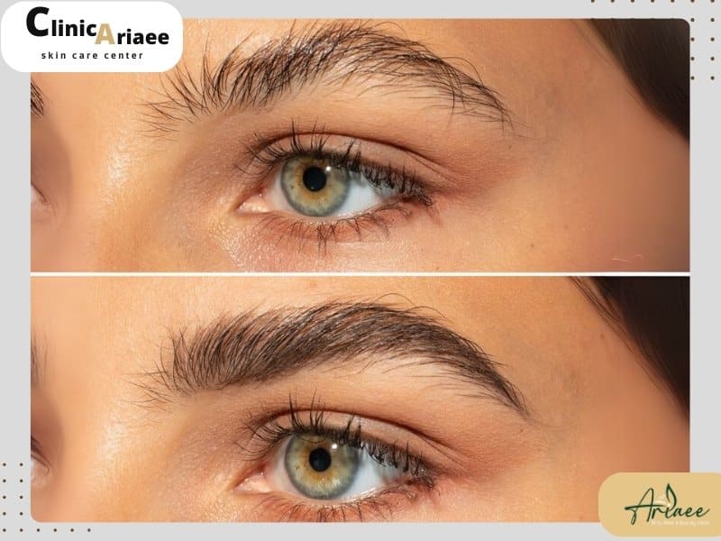  آیا روغن سیاه دانه برای تقویت ابرو مفید است؟