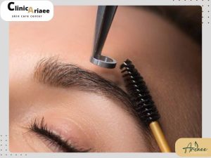مقایسه ریموو ابرو با لیزر و مواد