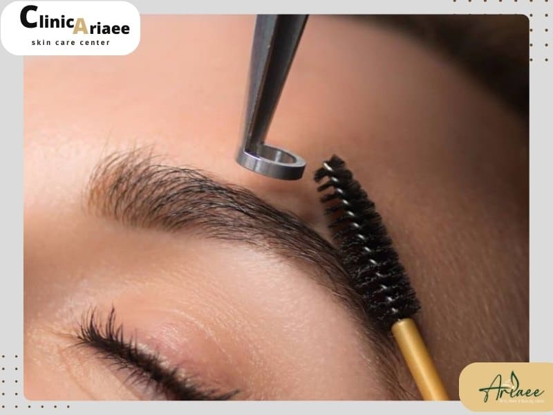  عوارض پاک کردن تاتو ابرو با ریموور و نکات مهم در این روش