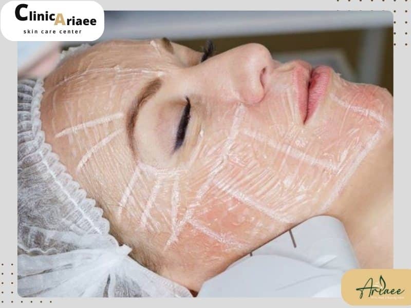 چگونه بهترین مرکز هایفو را انتخاب کنیم؟