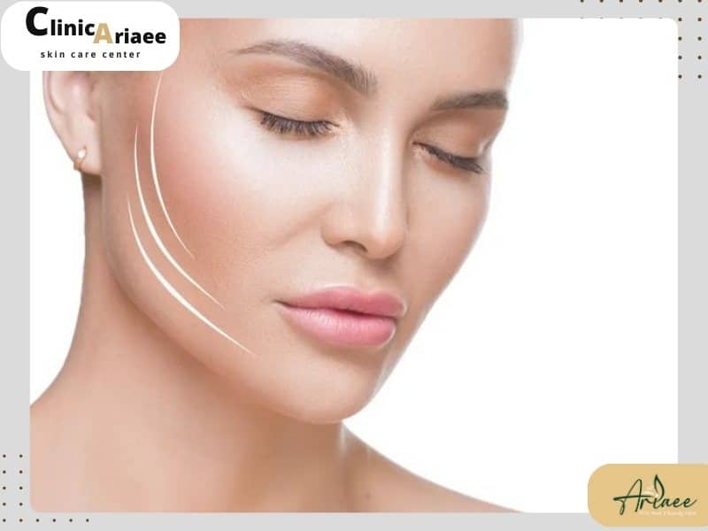 انتخاب بهترین پزشک برای لیفت صورت با نخ