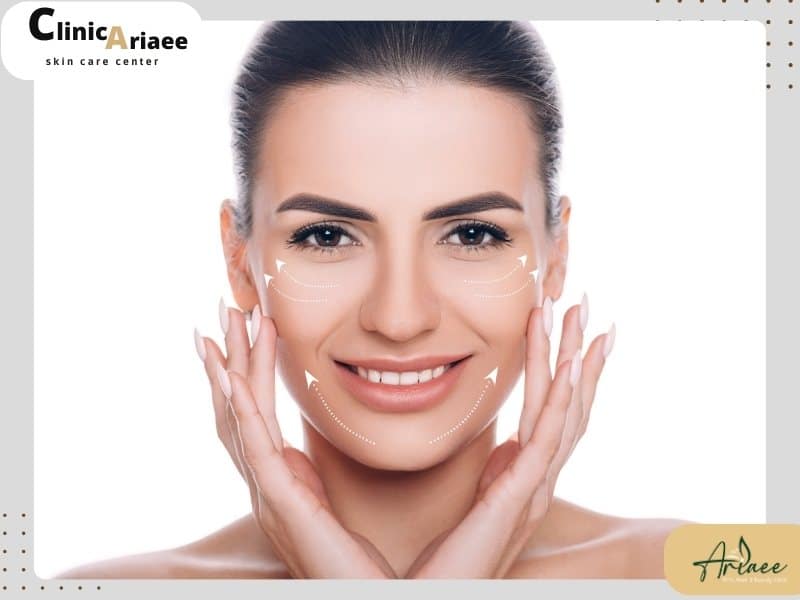 مکانیزم اثرگذاری لیفت با نخ