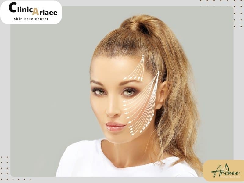 بهترین دکتر لیفت با نخ