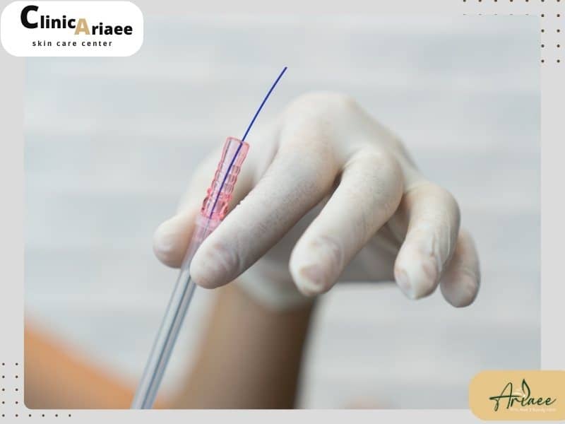 چه افرادی برای انجام لیفت با نخ مناسب نیستند؟