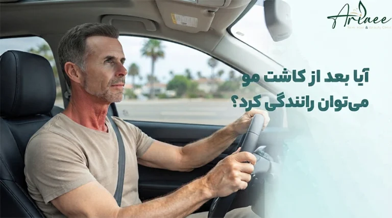 _آیا بعد از کاشت مو می _توان رانندگی کرد؟