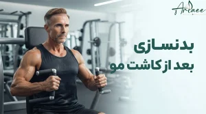 بدنسازی بعد از کاشت