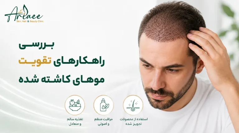 بررسی راهکارهای تقویت موهای کاشته شده