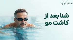 شنا بعد از کاشت مو