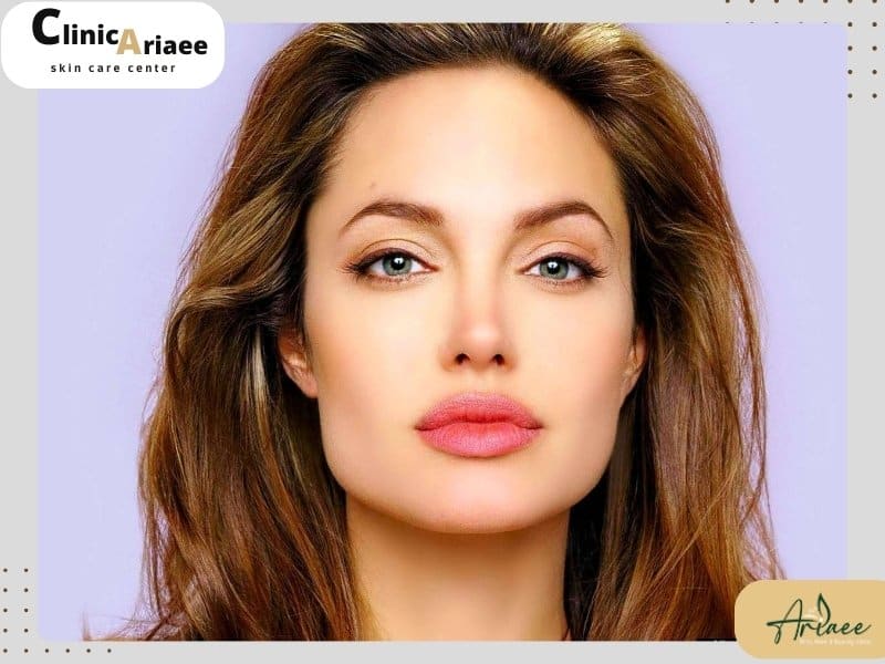 تعادل ویژگی ها