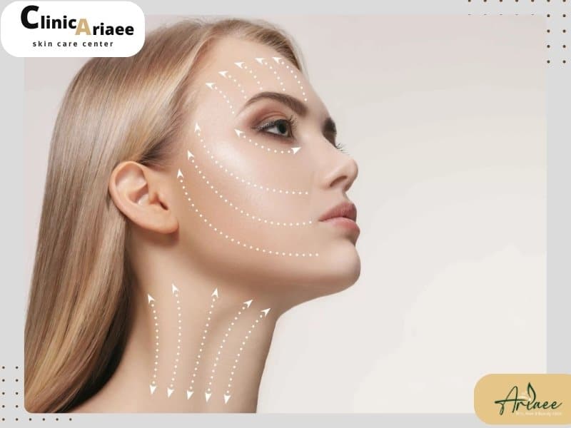 لیفت ابرو با نخ مناسب چه کسانی است؟