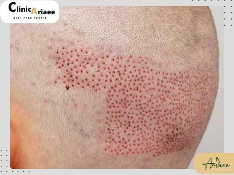 ویژگی های بانک موی قوی
