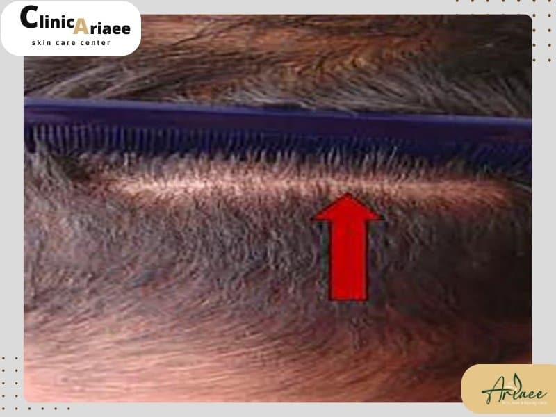 بانک مو چیست؟