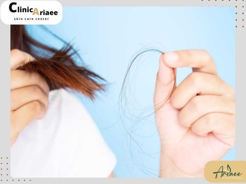 برای جلوگیری از ریزش مو چه راه و روش هایی وجود دارد؟