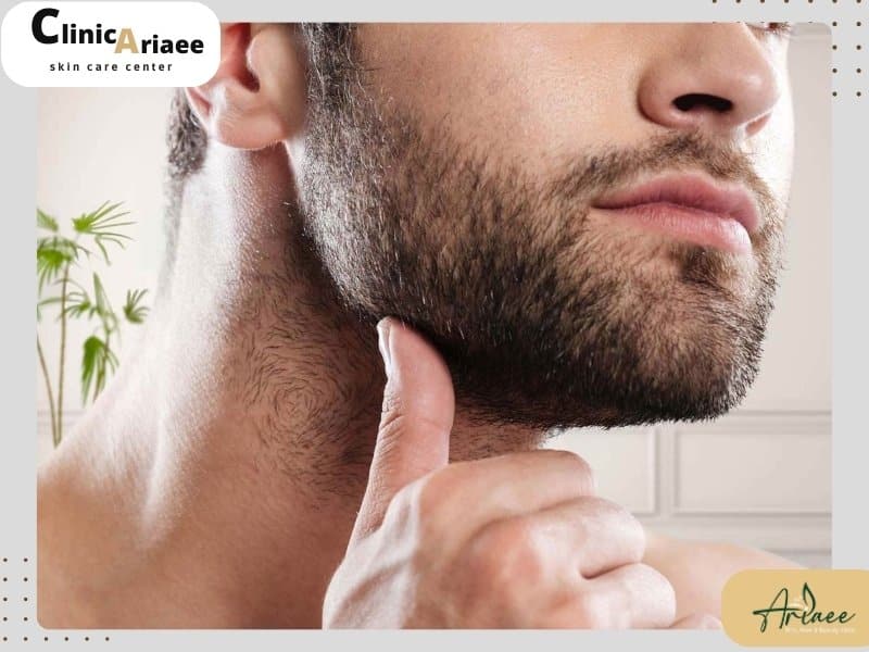 مزایا و معایب برداشت مو از ریش