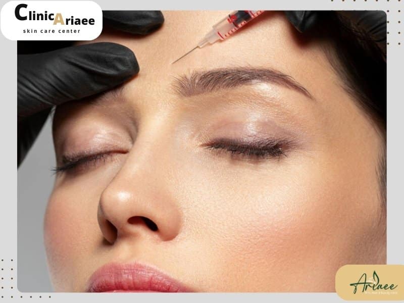 بوتاکس چیست؟