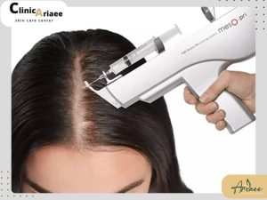 انواع دستگاه مزوتراپی مو