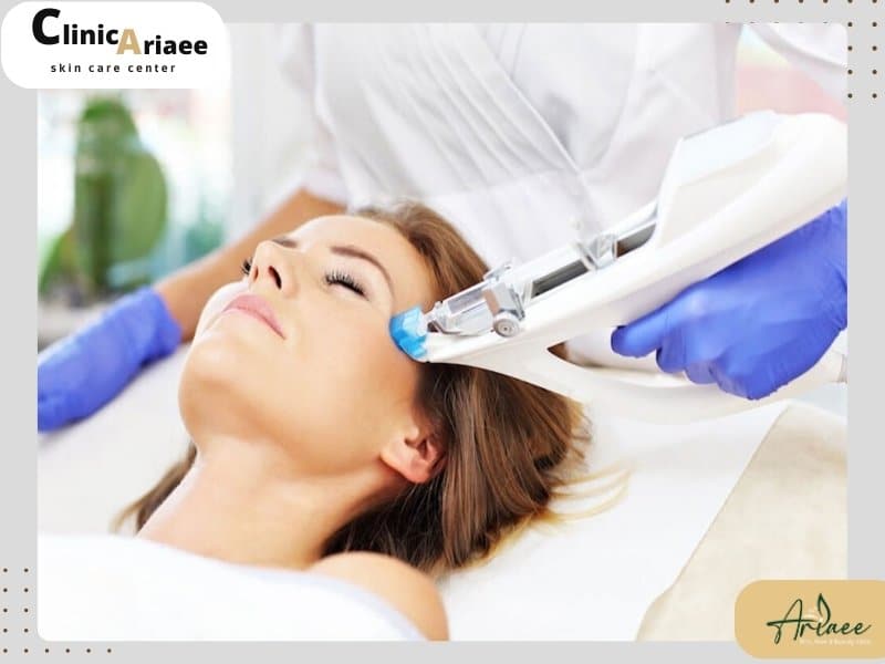 کاربردهای مختلف روش مزوتراپی