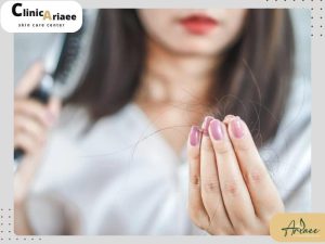 تاثیر استرس بر ریزش مو