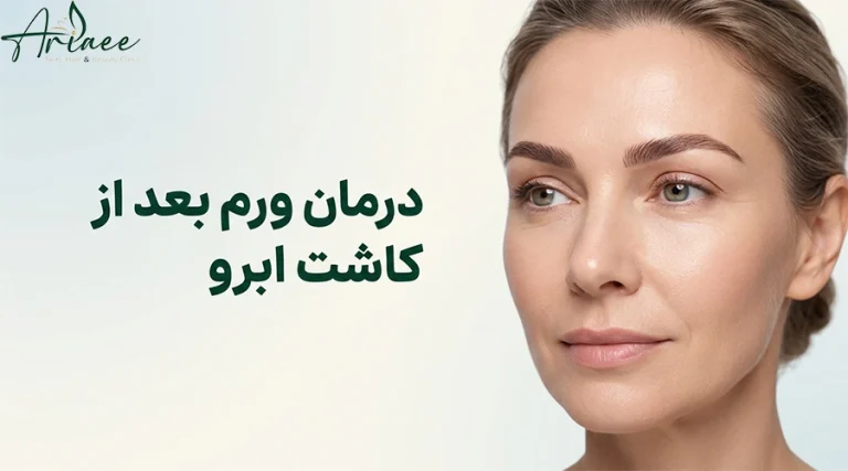 درمان ورم بعد از کاشت ابرو