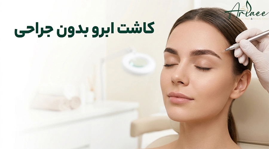 کاشت ابرو بدون جراحی