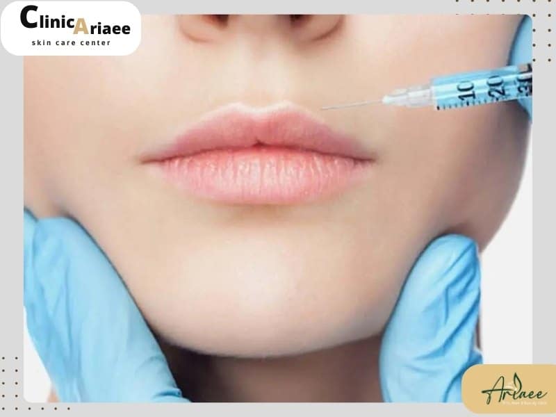 نکروز بعد از تزریق ژل چه زمانی خطرناک است؟