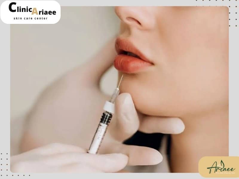 روشهای درمانی نکروز بعد از تزریق ژل