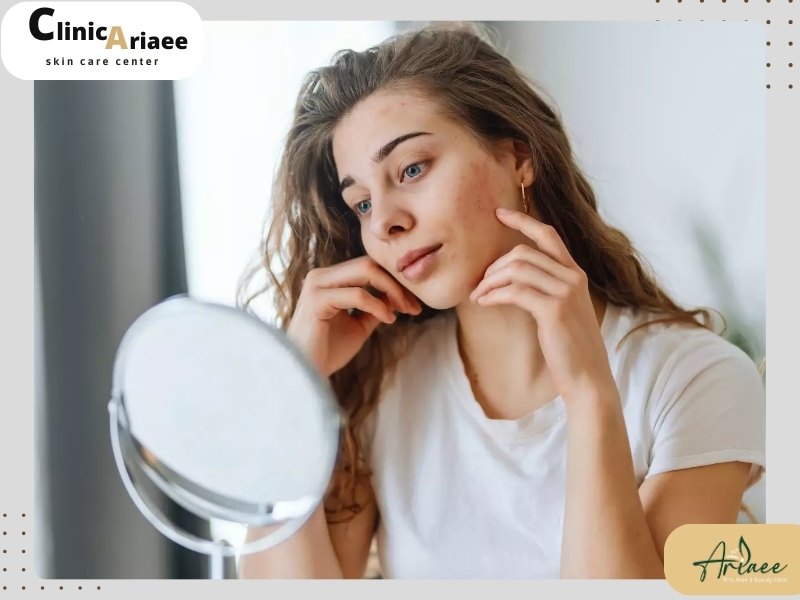علائم خشکی پوست در پاییز