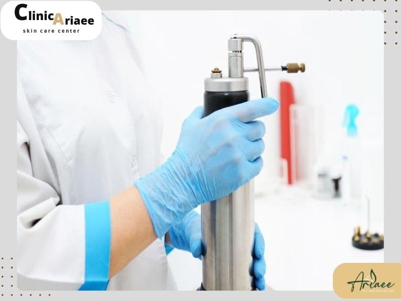 مراقبتهای پس از کرایوتراپی