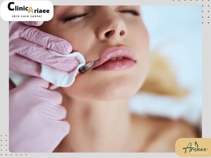 فرآیند ترمیم ژل لب چگونه انجام میشود؟