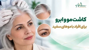 کاشت مو و ابرو برای افراد با موهای سفید