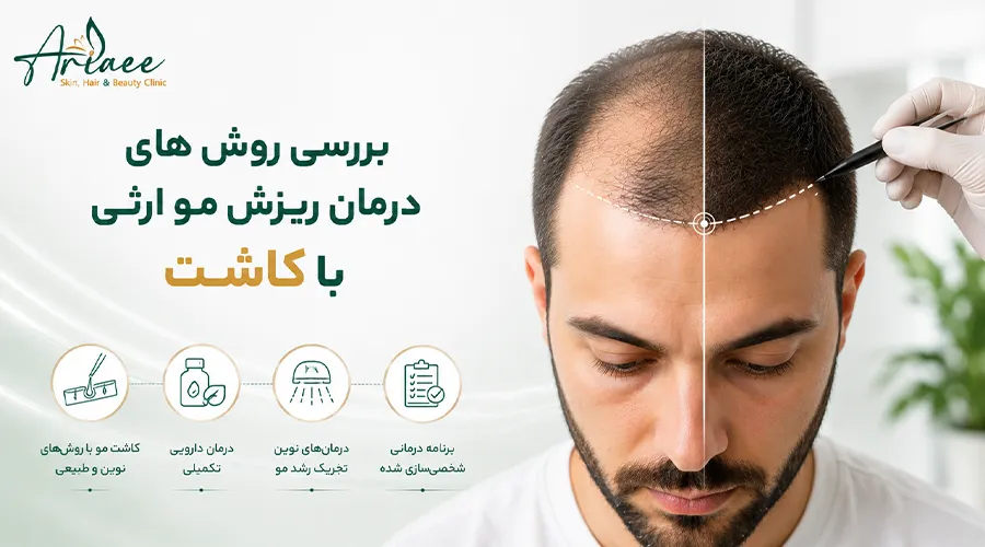 بررسی روش های درمان ریزش مو ارثی با کاشت