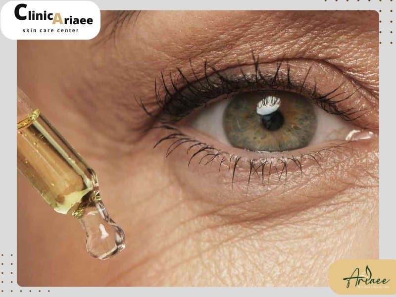 روشهای درمانی چین و چروک های دور چشم